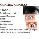 botulismo 9 728
